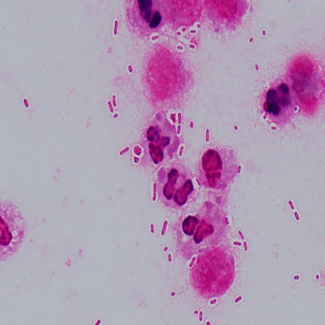 GROUP/TRAIN Object Detection Dataset by 14bacteriatestcheck