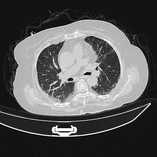 ct_test Instance Segmentation Dataset by Mengyu Wang