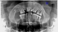 dental-label-tool project thumbnail