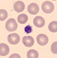 Bood-Cell project thumbnail