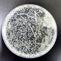 Petri dishes project thumbnail