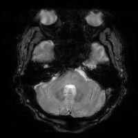 brain project thumbnail