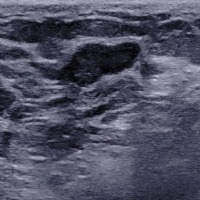 Ultrasound project thumbnail