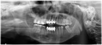 teethdentex project thumbnail