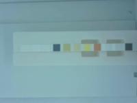 Urine-strips project thumbnail
