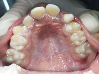jaw_classification project thumbnail