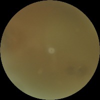 eye_diseases_classification project thumbnail