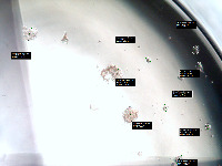 Techlabs Cancer Detection project thumbnail