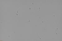 Sperm3 project thumbnail
