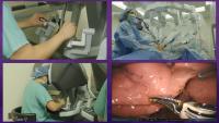Surgical instrument detection project thumbnail