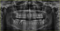Dental AI SEG. project thumbnail