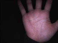 YOLO PALM DETECTION project thumbnail
