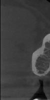 tooth2 project thumbnail