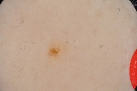 DermaVision Ai project thumbnail