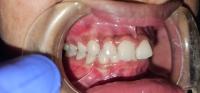 Dental Angle project thumbnail