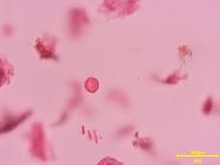 pollen_1101 project thumbnail