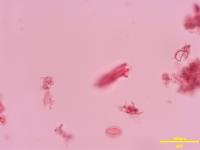 pollen_1102 project thumbnail