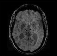 Brain project thumbnail