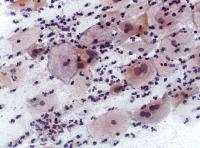 cytology project thumbnail