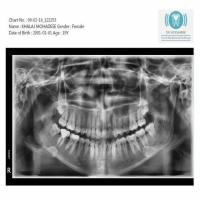 dentist xrays everything project thumbnail