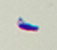 Sprem Classification project thumbnail