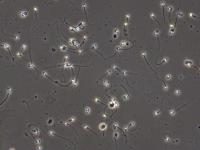 Sperm Segmenatation project thumbnail