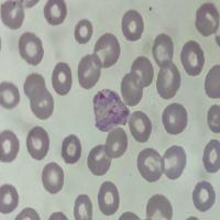 Malaria image project thumbnail