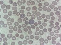 Plasmodium detection 2 project thumbnail