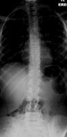 X_ray_Coronal project thumbnail