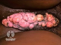 skin disease project thumbnail