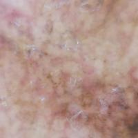 DermaSight project thumbnail