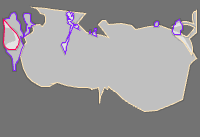 Obstacle Detection project thumbnail