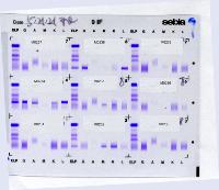 protein project thumbnail