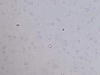 Particle segmentation project thumbnail