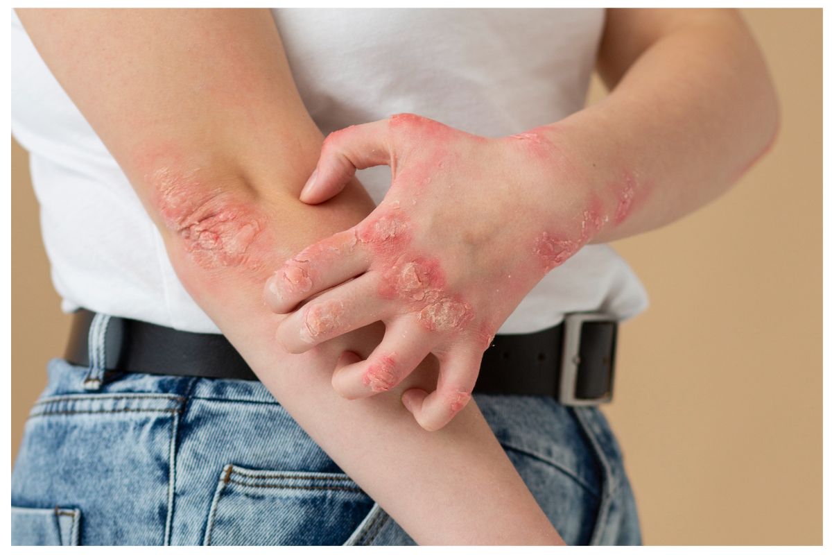 Braune Flecken Am Bein Diabetes Your Complete Guide To Prevention - up8o6if
