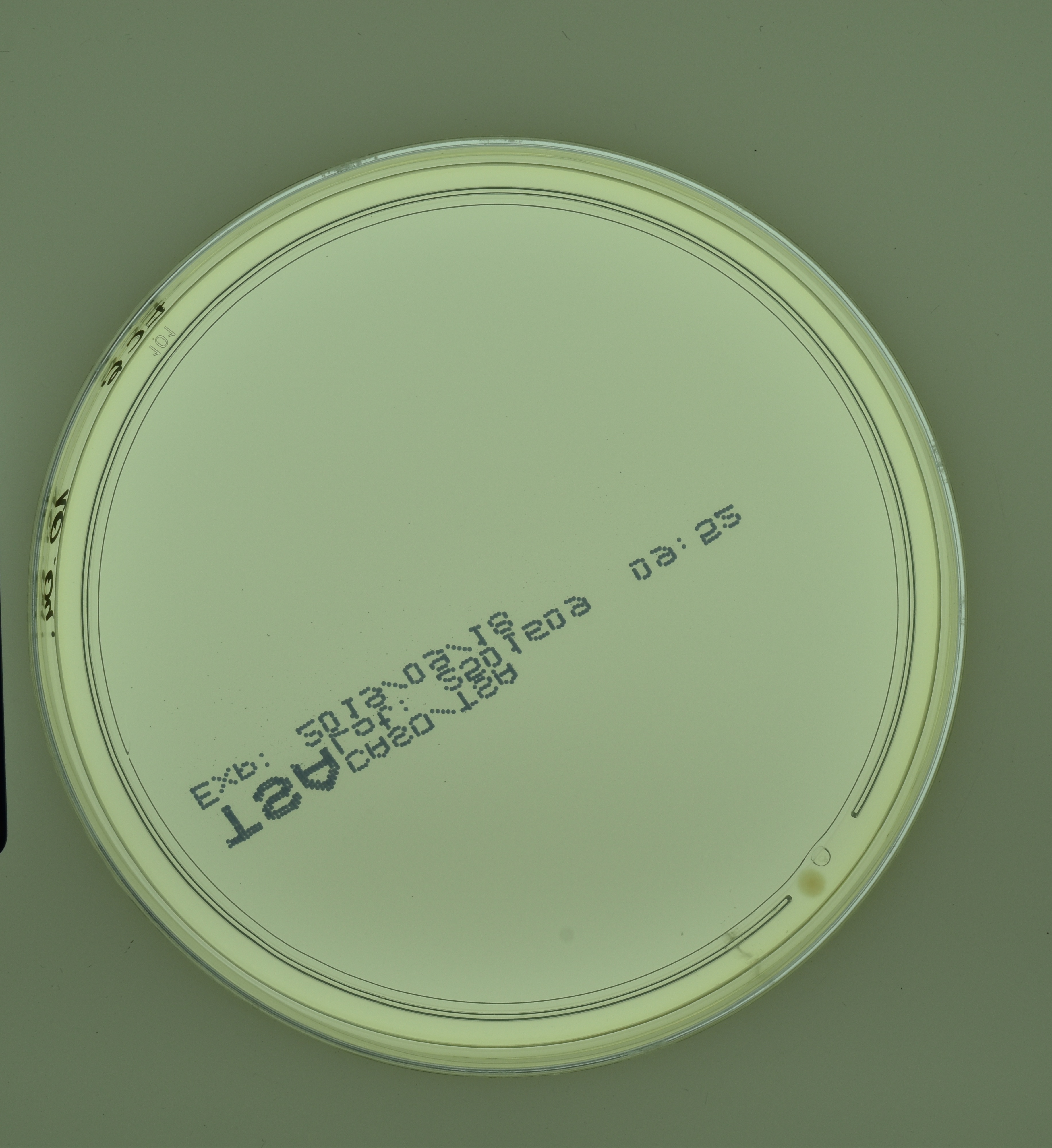 agar-lower Object Detection Model by agar