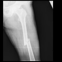 FractureDetectionAndClassify project thumbnail