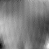 3D_scoliosis_afb16-20 project thumbnail