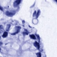 Research Giemsa project thumbnail
