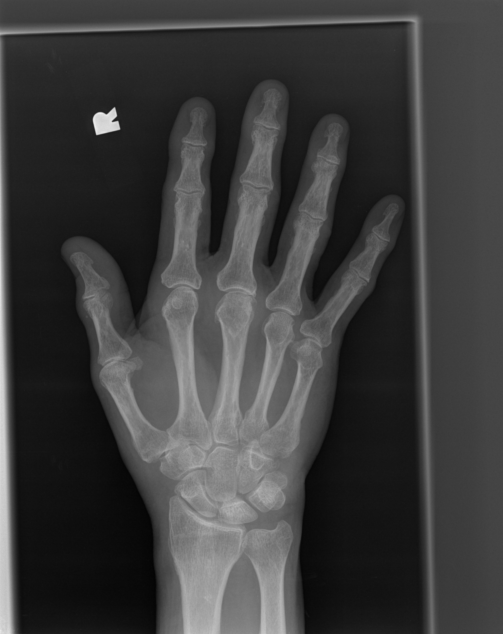Hand Joint2 Object Detection Dataset by Hello