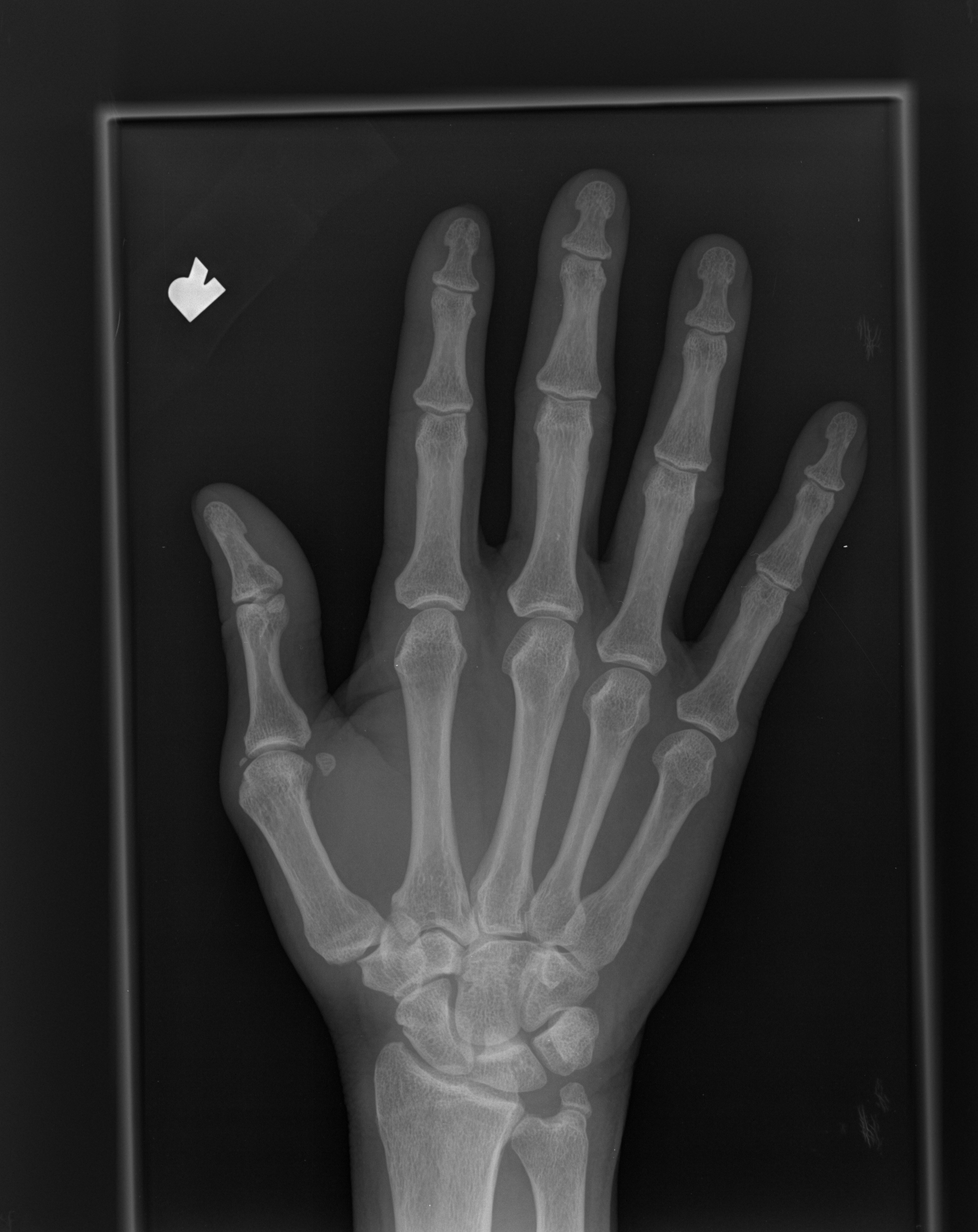 Hand Joint Object Detection Dataset by Hello