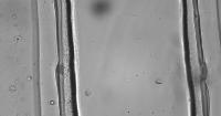 wbc-rbc-new-fast project thumbnail