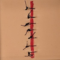suture analysis project thumbnail