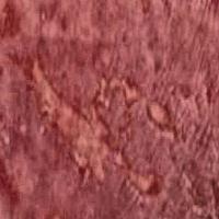 Pressure-Ulcer-Segmentation project thumbnail